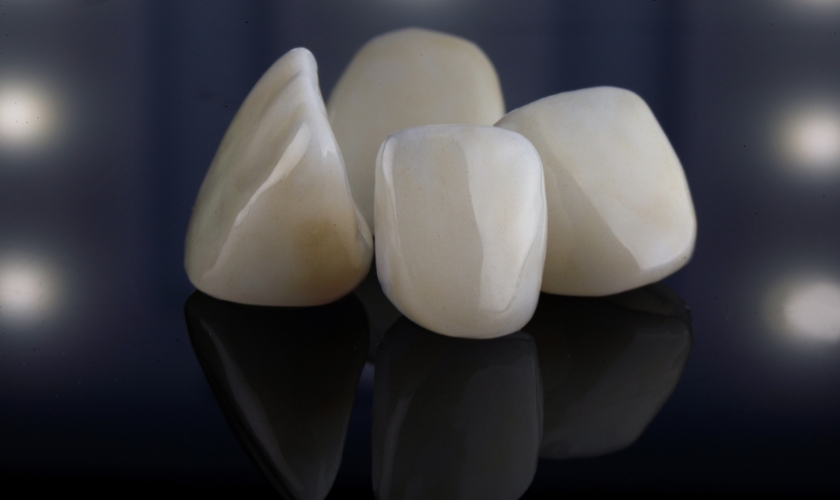 Managing Major Pain After Dental Veneers