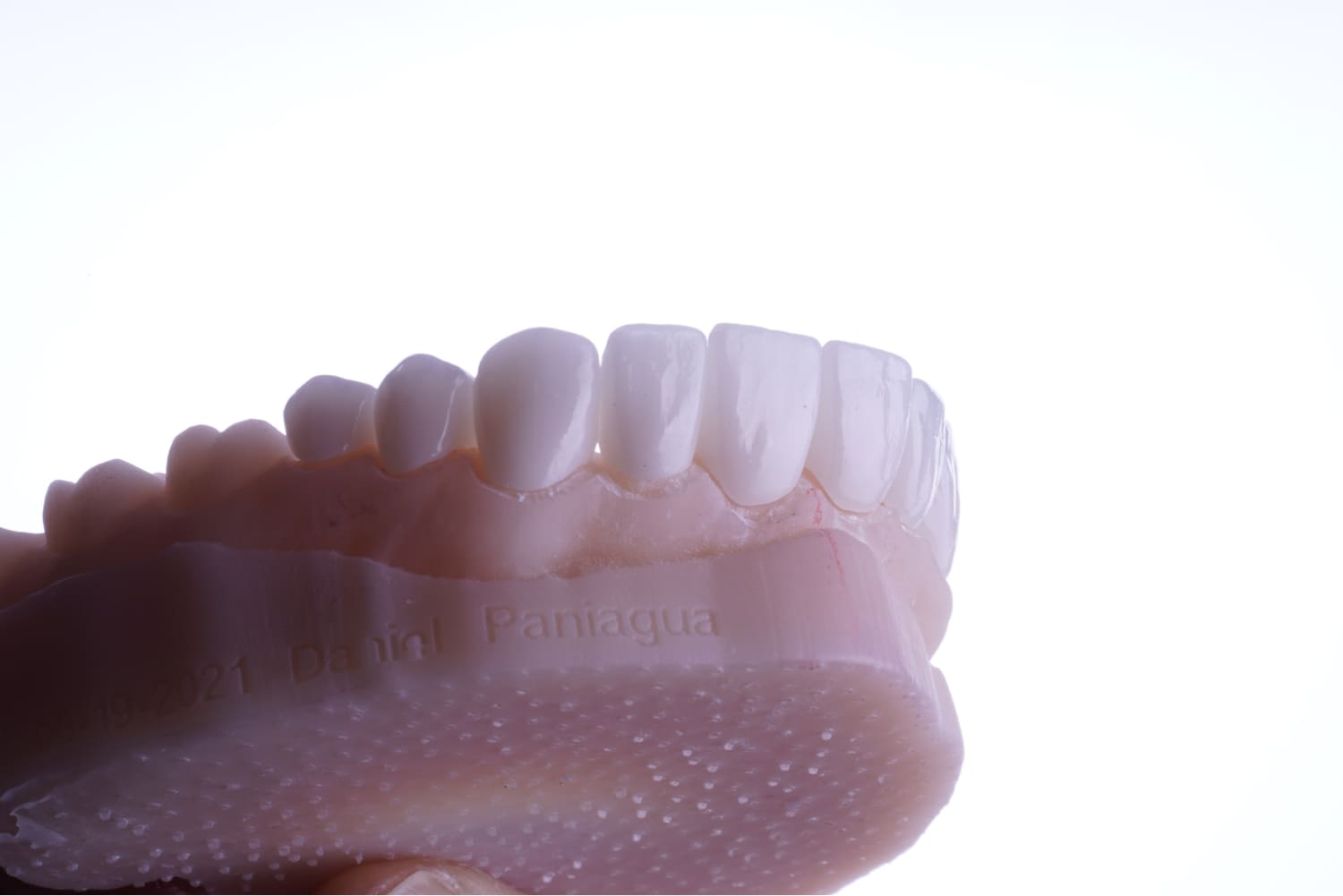 Tooth Bonding Dallas TX Floss Dental