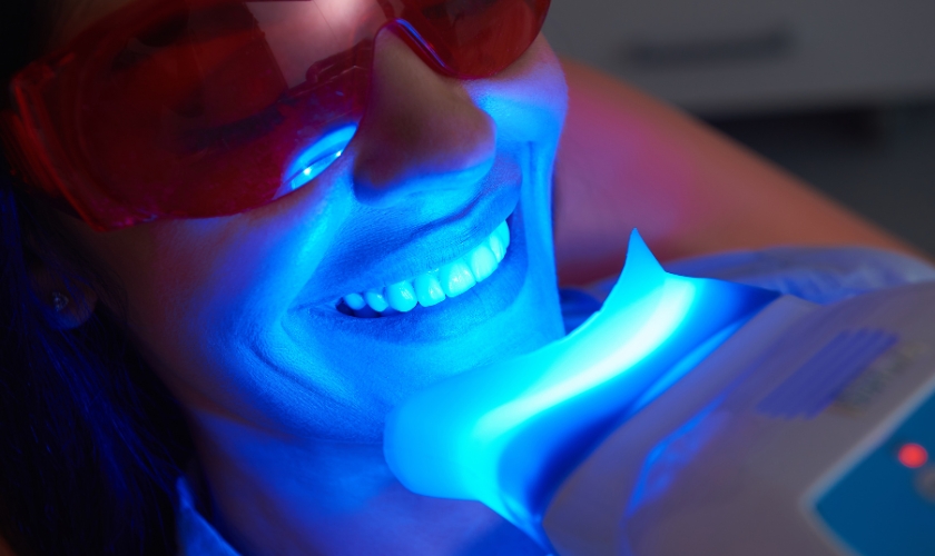 Pros and Cons of Laser Teeth Whitening Revealed!