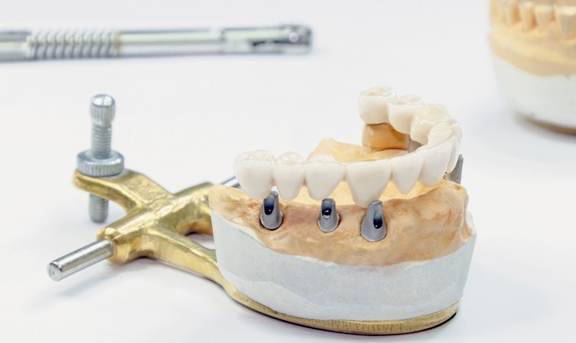 Missing Teeth? Don't Despair! Exploring Full & Partial Dentures